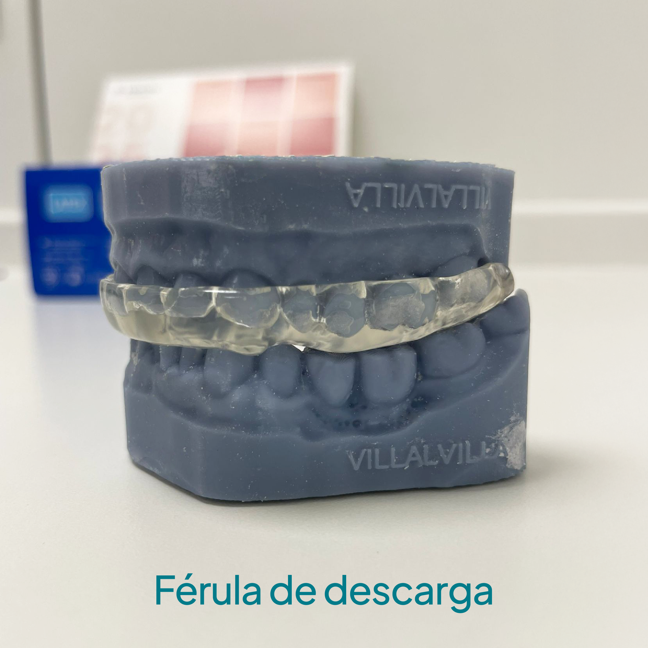 Férula de descarga como tratamiento para el bruxismo
