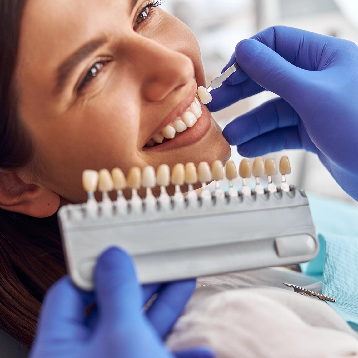 Carillas dentales en Clinica Dental Villalvilla, Xirivella