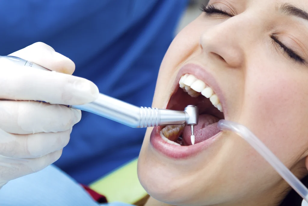 Limpieza oral en el dentista