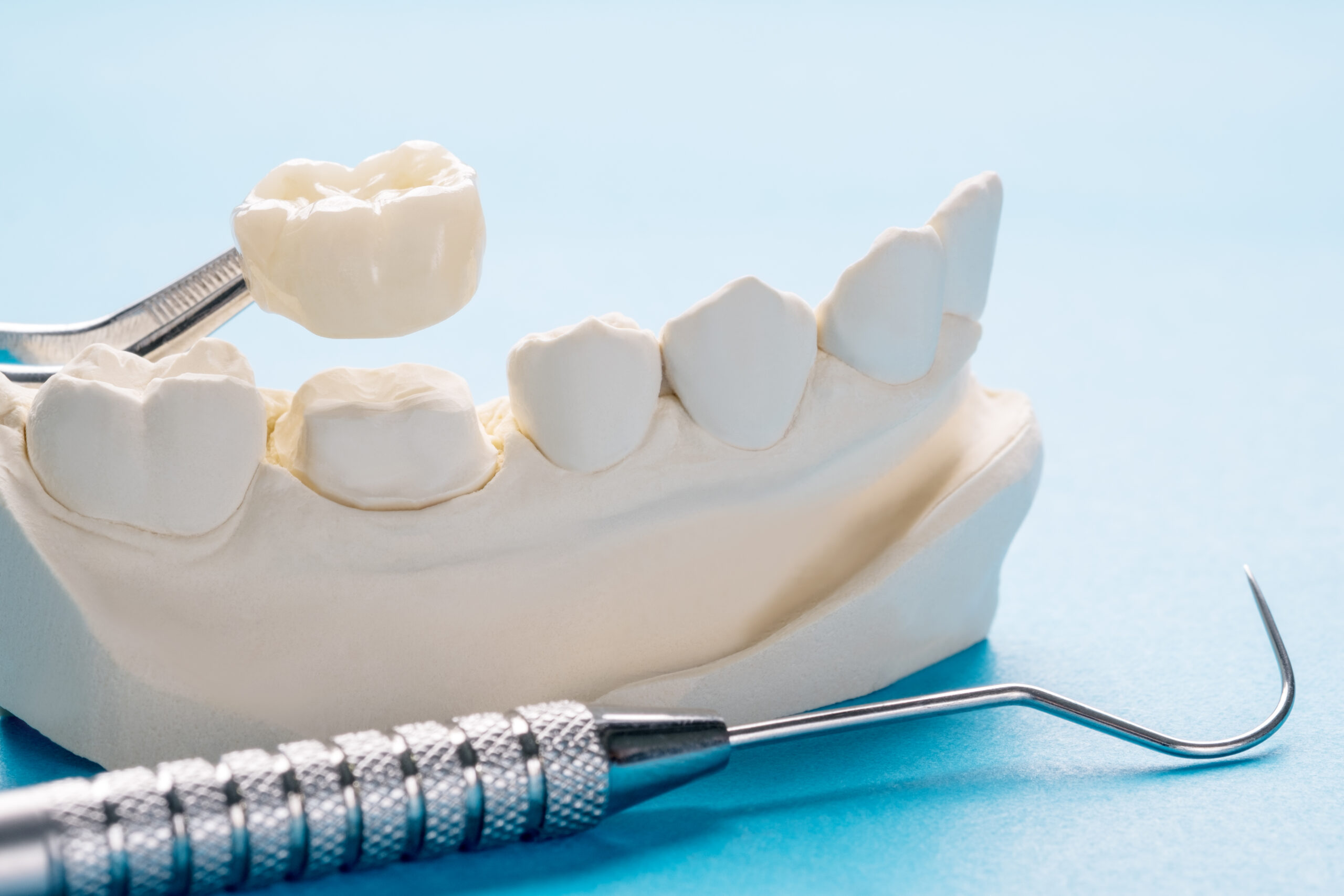 Primer plano corona dental