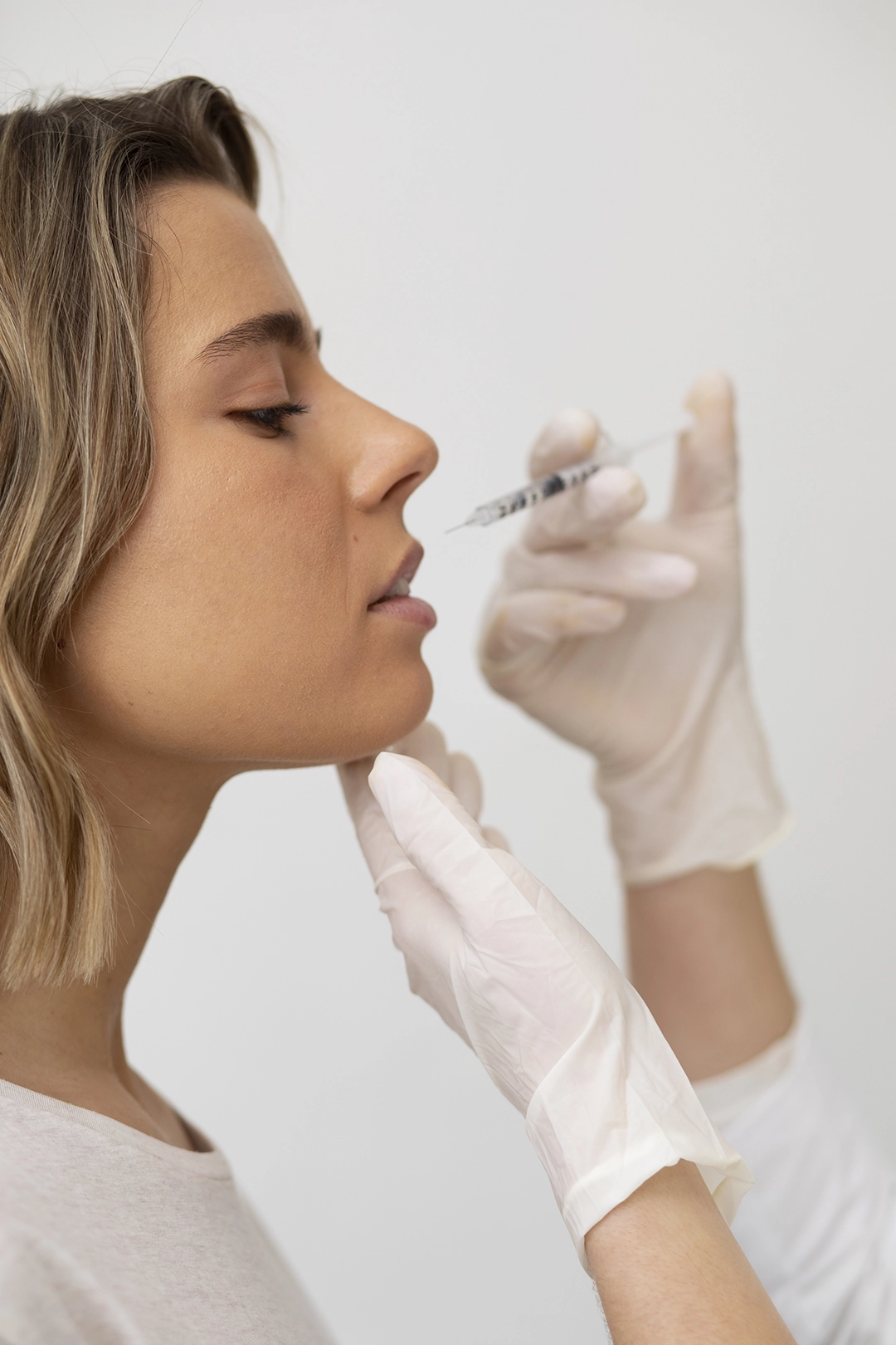 Relleno con ácido hialurónico en Clínica Dental Villalvilla, Xirivella